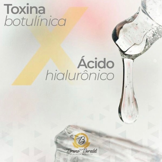 Toxina Botulínica ou Ácido Hialurônico? Qual escolher?