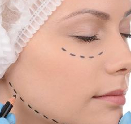 lipoenxertia-de-face-
