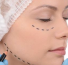 lipoenxertia-de-face-